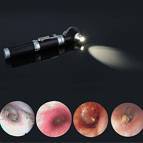 Image of STEPWELL LED Otoscope (White Light) Pocket Scope, with Battery Handle for Medical Professionals (Professional 2)