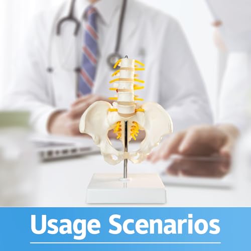 Image of Male Pelvis Model, Educational Model with 5 Lumbar Vertebrae and Spine with Spinal Nerves for Medical Research and Educational Practice