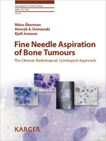 Fine Needle Aspiration of Bone Tumours: The Clinical, Radiological, Cytological Approach (Monographs in Clinical Cytology)