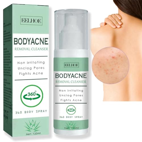 Back Acne Treatment Spray,Acne Treatment Spray,Body Acne Treatment,Acne Moisturiser for Back,Back Acne Spray Smooth Skin,Acne Back Treatment,Body Acne Spray,Skin Care for Acne Spray for Body Acne