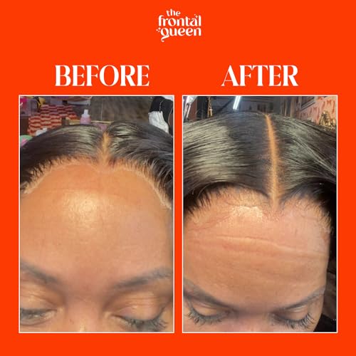 the frontal queen lace melting spray ashy lace melting spray for lace wigs lace bond spray extra hold lace melting spray adhesive wig no residue long lasting safe formula - 42 oz