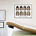 Posterazzi Hair Loss Poster Print by Gwen Shockey/Science Source, (24 x 18), Varies
