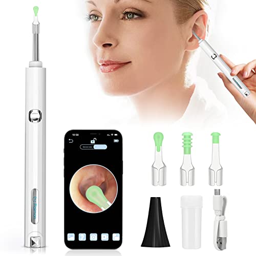 Ohrenschmalz Entferner, Otoskop Ohrreiniger Ohrenschmalz mit Kamera,Ohrenreiniger mit 3MP HD Ohr Endoskop, 6 LED-Leuchten, IP67 wasserdicht Ohrenschmalz-Entfernungsset für Erwachsene Kinder Haustiere Cover