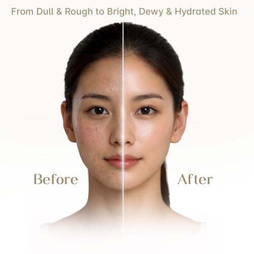 Image of Seoulskin Kojic Rice Water Brightening Soap Pack of 3 & Rice Water Moisturising Sunscreen SPF 50 PA++++ Combo for Tan Removal, Pigmentation, Dark Spots & UV Protection | For Men & Women