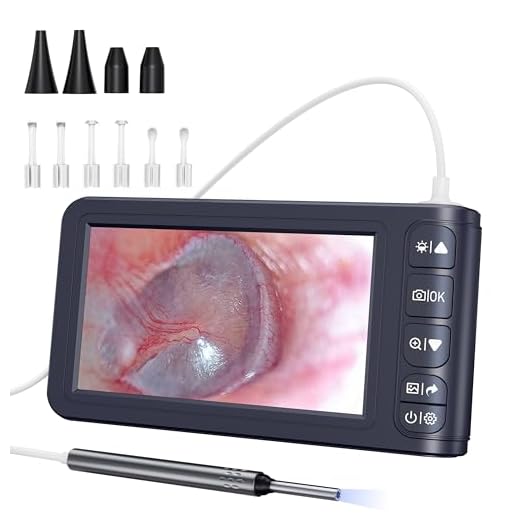 Digital Otoscope Camera with Light, Qimic Ear Camera with 5-inch IPS Screen, Ultra Clear View Ear Scope Camera, 3.9mm Ear Wax Removal Tool, Supports Photo and Video Recording, Built-in 32GB Card