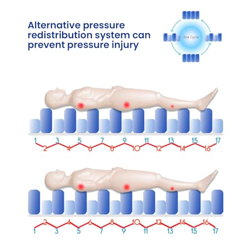 Image of AroKleen ARO Care Anti Decubitus Bubble Air Mattress for Patients Bed Sore with Pump | Anti Bedsore Anti-Decubitus Mattress Pad, Inflatable Air Bed | Bubble Mattress- 1 Year Warranty