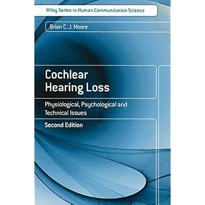 Cochlear Hearing Loss