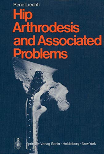 Hip Arthrodesis and Associated Problems view 2