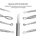 5 Piezas de herramientas (Conjunto) para eliminar espinillas, Extractor de acné, Herramienta...