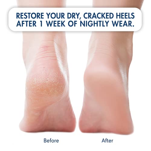 Dr. Frederick's Original Moisturizing Heel Socks For Cracked Heel Treatment - 2 Pairs - Stop Cracked Heels In Their Tracks #TOP1