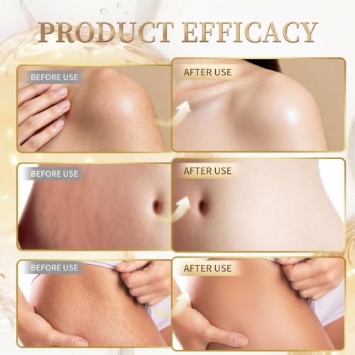Reafirmante para la piel con efecto lifting e hidratante corporal 7