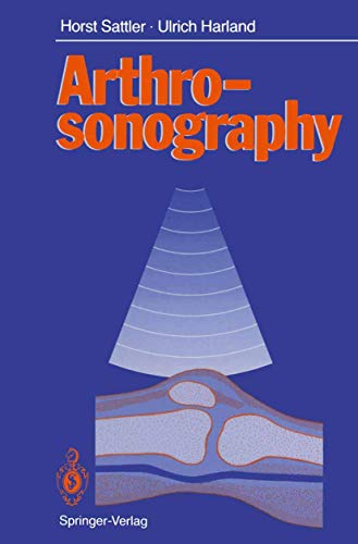 Arthrosonography view 2