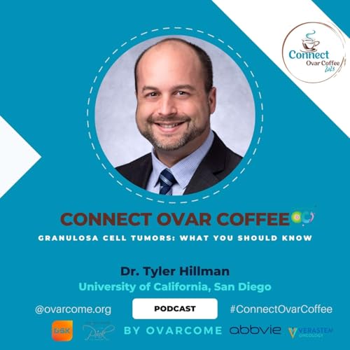 Granulosa Cell Tumors in Ovarian Cancer: What You Should Know