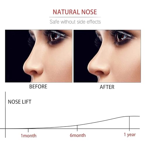 Image of EZ LIVING Precision Nose Shaper Clip for Defined and Symmetrical Nose Contouring Adjustable Design Comfortable Fit and Effortless Nose Reshaping