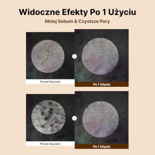 NIDA Perfect Clear™ podwójny środek czyszczący do oleju | Olejek jojoba, drzewo herbaciane, ekstrakt z ryżu | zanieczyszczenia, nadmiar łoju, oczyszczanie porów, zaskórniki | 145 ml (4,90 fl oz)
