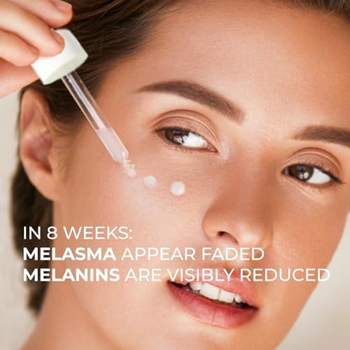 Abera Melasma Serum, Melanin Correcting Facial Serum, Dark Spot Corrector For Age Spot Sun Spot Freckles thumb #6