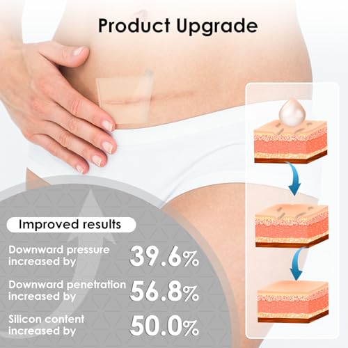 SWturk Silicone Scar Sheets,Silicone Scar Tape for Removal Treatment,Reusable Medical Grade Scar Tape for Surgical Scars,C-Section,Scar Removal Away(1.6\" x 60\" Roll - 1.5M) Keloid Bump Removal - Thumbnail 5