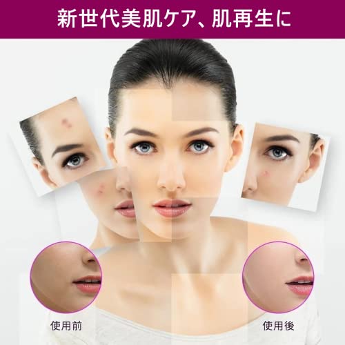 SrDiot ダーマローラー 0.25mm の商品画像 5