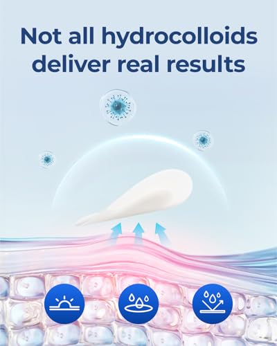 POINTMASS Adesivos de espinhas para acne facial: adesivos de espinha hidrocolóide ultrafinos de 0,1