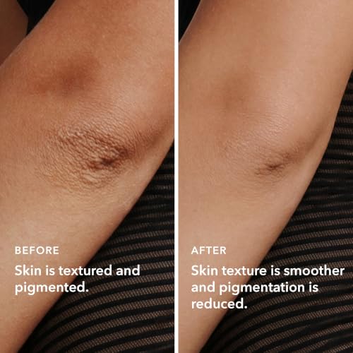 Image of Boofootel SooperDuo Face & Body Serum Combo for Pigmentation & Bumpy Skin | Multi-Active Serums: Vitamin C, Niacinamide, Glycolic Acid, Peptides & Hyaluronic Acid for Uneven Tone, Rough Texture & Glow