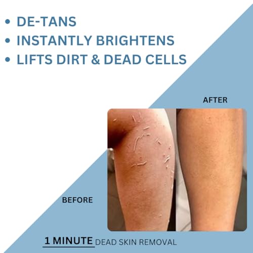 Image of U16 Dead Skin Removal Exfoliating Gel with Cellulose, Lactic Acid & Scrub Beads