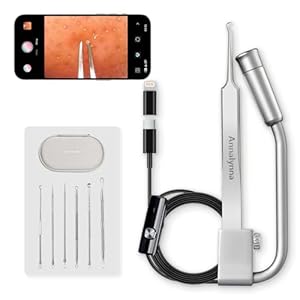 Annalynna Luma 1 Visuelle Mitesser-Pinzette mit Kamera