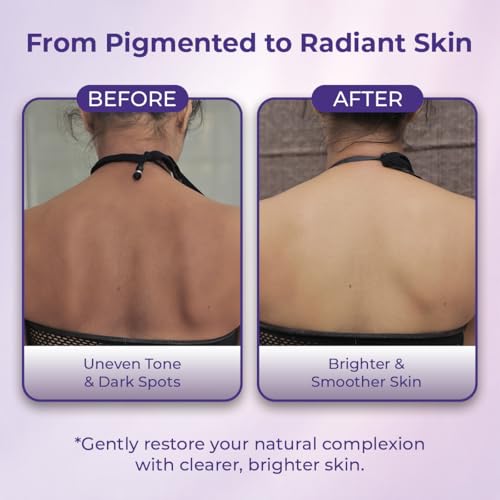 Image of Sanfe Soaps Kojic Acid Soap for Bath | 75g | Pack of 1 | Detan Soap | Dark Spots Brightening & Pigmentation Removal | Skin Whitening Soap Bar | Tanning Removal Soap for Men & Women