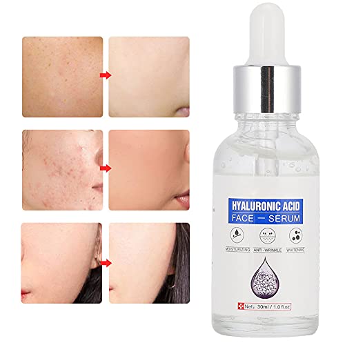 Acido Ialuronico Siero Viso Nutriente Pelle