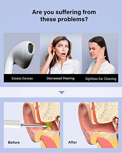 Bebird® C3 Ear Cleaner, Ear Wax Removal Tool Wireless Otoscope With 1080P Hd Waterproof Digital Endoscope With 6 Led Light, Mom Gadgets For Baby Ear Cleaner Checking #TOP1