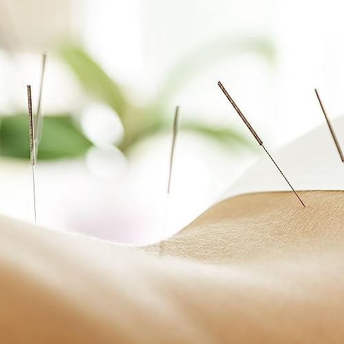 Acupuncture for Your Good Health!