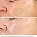 Crema Correctoras y Anti-Imperfecciones - Crema Faciales Mujer Hidratante, Antiarrugas, Antimanchas |...