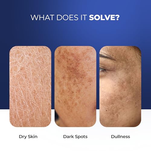 Image of Aqueria Brightening French Moisturizer for Barrier Repair with 3% Niacinamide for Fading Dark Spots | Alpha Arbutin for Visible Brightness | Glutathione for Brightening and Barrier Repair | Brightens, Fades Blemishes, Improves Skin Tone | Dermatologist Tested | All Skin Types | Women & Men | Moisturizer For Face | Barrier Repair Cream | Long Lasting Hydration | Non-Comedogenic | 50g