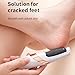 Boulton Electric Foot File Hard Skin Remover for Feet – Rechargeable Callus Remover Pad Foot Scraper with 2 Roller Heads, Professional Pedicure Tool for Dry & Cracked Heels