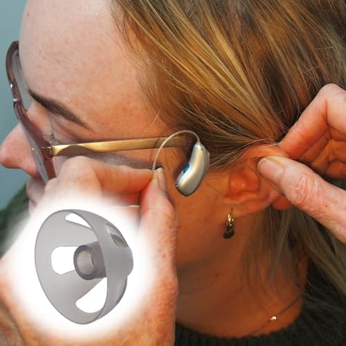 10Stk Hörgeräte Dome Ohrstöpsel,Hörgeräte Kuppel Weich,Offener Dome aus Silikon für Hörgeräte,Open Domes Hörgeräte Ohrstöpsel,Weiche schwarze Hörgeräte-Ohrstöpsel,für ältere hörgeschädigte Menschen