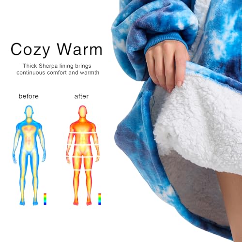 Kipswiza Wearable Blanket Hoodie, Oversized Cozy Warm Sherpa Fleece Hooded Blankets Sweatshirt - Gifts for Mom, Dad, Women, Men, Teens, Adult (Blue Tie Dye)