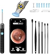 AROSKY Ear Wax Removal 1920P Clearest Ear Camera with Light Visible Ear Cleaner Ear Wax Removal K...