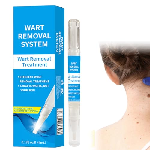 IWIDYA Penna Anti-Verruche,rimuove le verruche senza dolore, adatta a tutto il corpo, portatile e facile da usare, adatta a tutti i tipi di pelle.