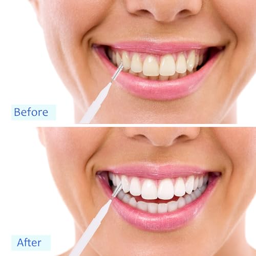 Image of Patelai 100 Pieces Braces Dental Brush for Cleaner Interdental Toothpick Dental Tooth Flossing Head Oral Hygiene Flosser Toothpick Cleaners Tooth Tool(White, Light Pink,Multiple Sizes)