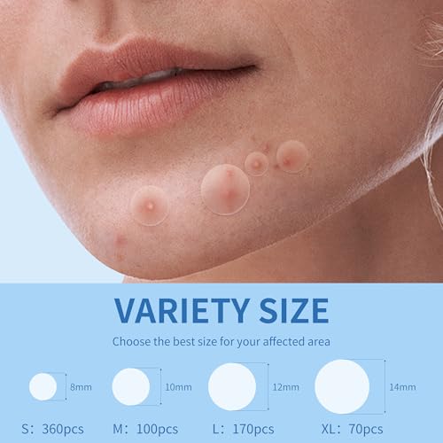 Image of Daolyo Pimple Patches for Face, 4 Size 700 Counts Acne Patches, Hydrocolloid Patches for Covering Zits and Blemishes, Spot Stickers with Salicylic Acid, Tea Tree Oil & Calendula Oil