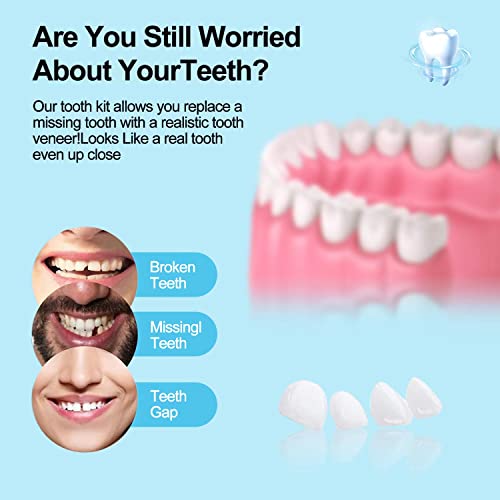 Tooth Repair Kit，Filling The Missing Broken Tooth And Gaps,Moldable Fake Teeth And Thermal Beads Replacement Kit，Regain Confidence Smile（White-K1） #TOP2