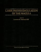 Laser Photocoagulation of the Macula 0397511183 Book Cover