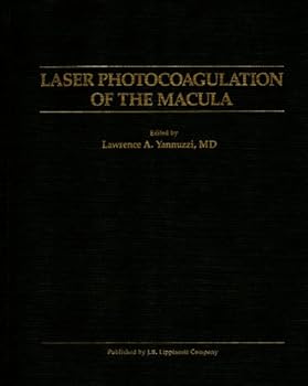 Hardcover Laser Photocoagulation of the Macula Book