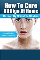 How To Cure Vitiligo at Home: (Backed by Scientific Studies) 1537355368 Book Cover