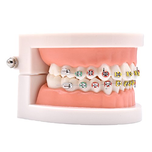 Angzhili 1 Piece Dental Demonstration Orthodontic Model With Metal Wires And Bracket (Metal Bracket) #TOP2