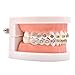 Angzhili 1 Piece Dental Demonstration Orthodontic Model with Metal Wires and Bracket (Metal bracket)
