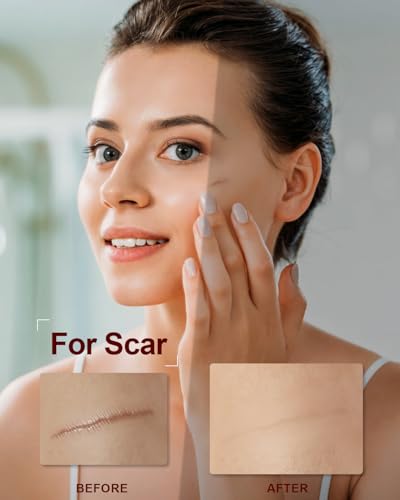 Organic Rosehip Seed Oil for Face,100% USDA Pure Rosehip Oils for Skin,Scars,Hair & Nails.2 fl Oz Cold Pressed Rose HIPS Oils for Skin Care, Anti-Aging, Scar Treatment, GUA SHA Massage Carrier Oil - Image 5