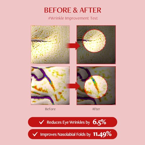 MEDITHERAPY Shumage Shot Gold Seal Lifting Ampoule, Gold Threads and Collagen Serum for Anti-wrinkles, Lifting Ampoule, Glowing Skin, Korean Skincare, 0.4 fl.oz