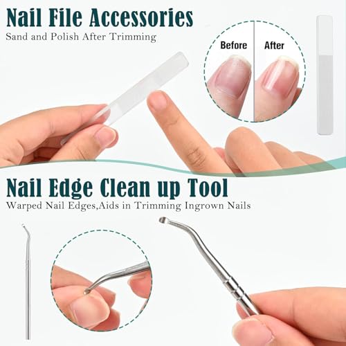 Image of TecoKart Nail Cutter Set - 3Pcs Sharp Stainless Steel Nail Clipper & Trimmer Kit for Adults, Professional Manicure Set for Men & Women, Portable Nail Cutter with Storage Box (Green)