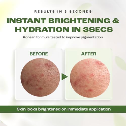 Image of WILDGLOW Niacinamide 5%,White Tea, Bisabolol, EGCG Brightening Serum for Hyperpigmentation, Dark Spots and Scar Repair | Look 10 years younger In 4 weeks, 60ml