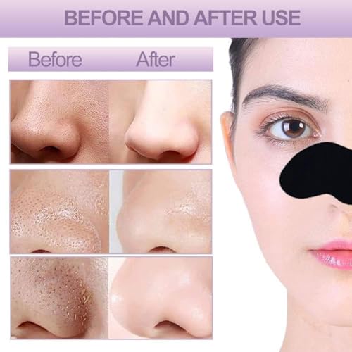 Image of Nose Strips for Blackhead & Whitehead Removal - Pack of 6 | Deep Cleansing Charcoal Pore Strips | Instant Nose Pore Cleaner for Men & Women